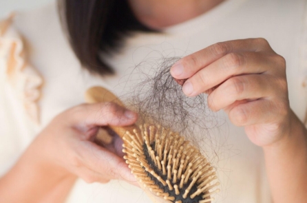 Rụng tóc báo hiệu điều gì về sức khỏe? Chiến lược điều trị và phòng ngừa nguyên nhân rụng tóc
