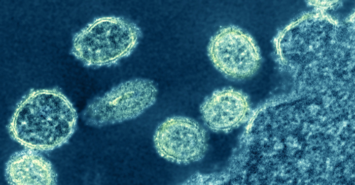 Virus cúm mới có ‘tiềm năng trở thành đại dịch’ được tìm thấy ở Trung Quốc