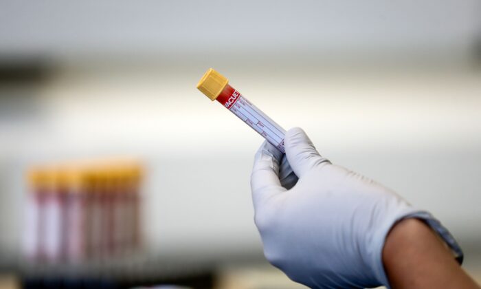 FDA nới rộng xét nghiệm cho người không có triệu chứng nhiễm virus Trung Cộng