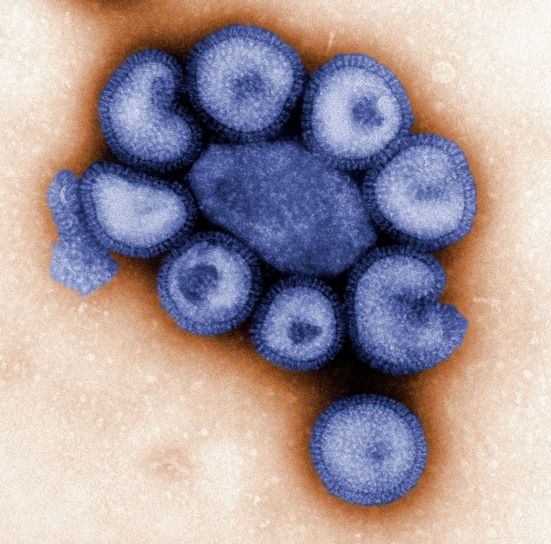 Virus cúm, nhất là virus cúm A, độc tính rất mạnh, xâm nhập vào đường hô hấp qua mũi miệng, nếu virus xâm nhập vào phổi sẽ gây viêm phổi, phù phổi.. (Ảnh Dr. F. A. Murphy từ Pixnio)
