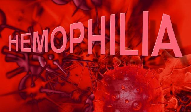 Bệnh máu khó đông - Hemophilia. (Ảnh syt.khanhhoa.gov.vn)
