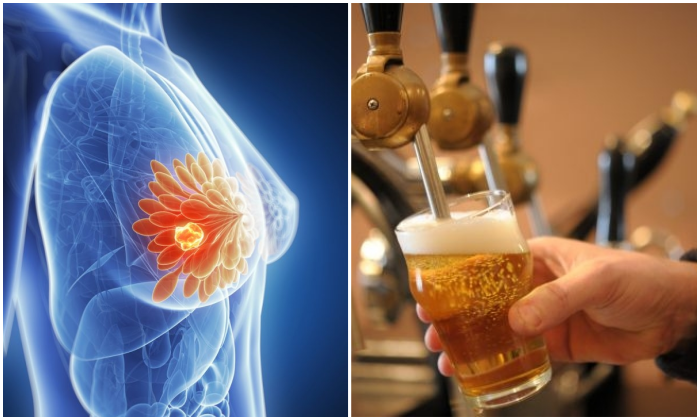 Mối liên hệ chết người giữa rượu và ung thư vú đang bị phái đẹp bỏ qua