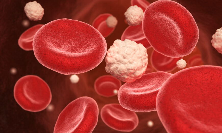 Vận động giúp tăng cường tuần hoàn máu(Tatiana Shepeleva/Shutterstock)