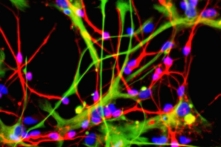 Tế bào thần kinh (màu đỏ) và tế bào hình sao (màu xanh lá cây), có thể tạo ra từ các tế bào gốc thần kinh. Ảnh do Viện Nghiên cứu Tế bào gốc công bố vào ngày 16/08/2005. (Ảnh: Viện Nghiên cứu Tế bào gốc qua Getty Images)