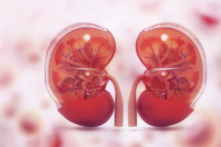 Acupuncture and Chinese herbal medicine can help improve kidney function. (Shutterstock)