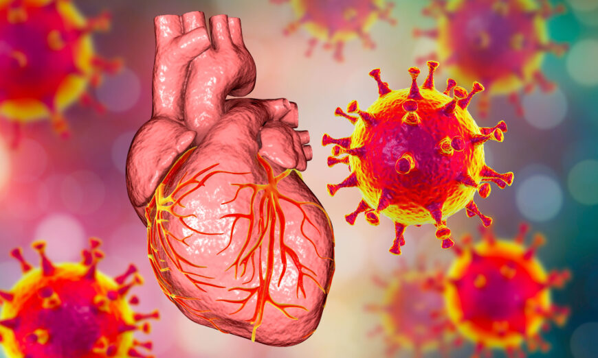 Vaccine mRNA gây viêm cơ tim bằng cách dẫn hướng các tế bào miễn dịch của chính bạn tấn công tim của bạn, điều này có thể dẫn đến đột tử do nhịp nhanh hoặc rung thất. (Ảnh: Kateryna Kon/Shutterstock)