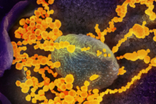 Hình ảnh kính hiển vi điện tử cho thấy SARS-CoV-2 (hình tròn màu vàng) gây ra bệnh COVID-19 xuất hiện từ các tế bào nuôi cấy. (Ảnh: NIAID)
