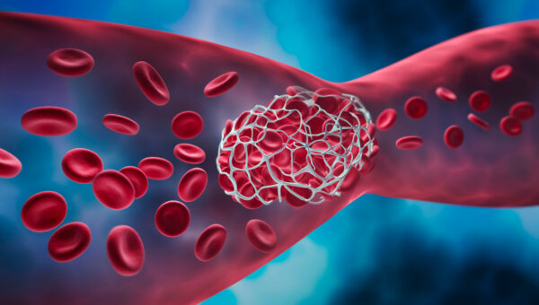 Khi mọi người già đi, các mạch máu trở nên kém linh hoạt hơn. (Ảnh: peterschreiber.media/Shutterstock)