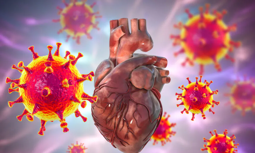 Một nghiên cứu xác định tỷ lệ cao các ca viêm cơ tim trầm trọng hậu chích vaccine COVID