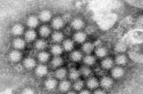 Một cụm virion norovirus. (Ảnh: Charles D. Humphrey/CDC qua AP)